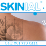 Skinial South Africa