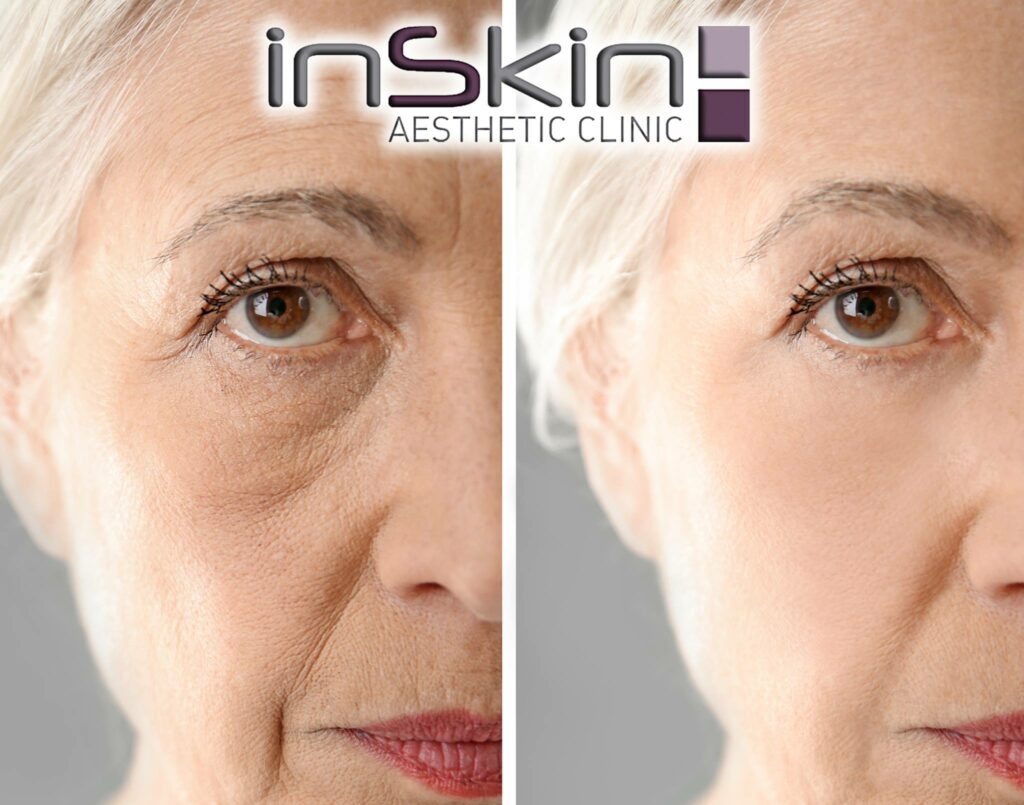 InSkin Aesthetic Clinic and Apilus Centre