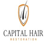 Hair Transplant experts in London UK