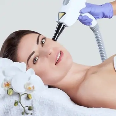 Fractional laser treatment in Florida