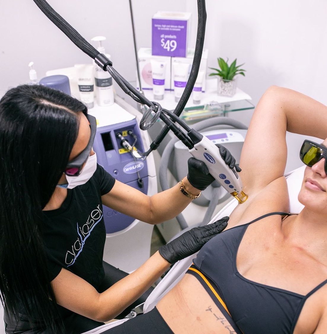 Laser hair removal