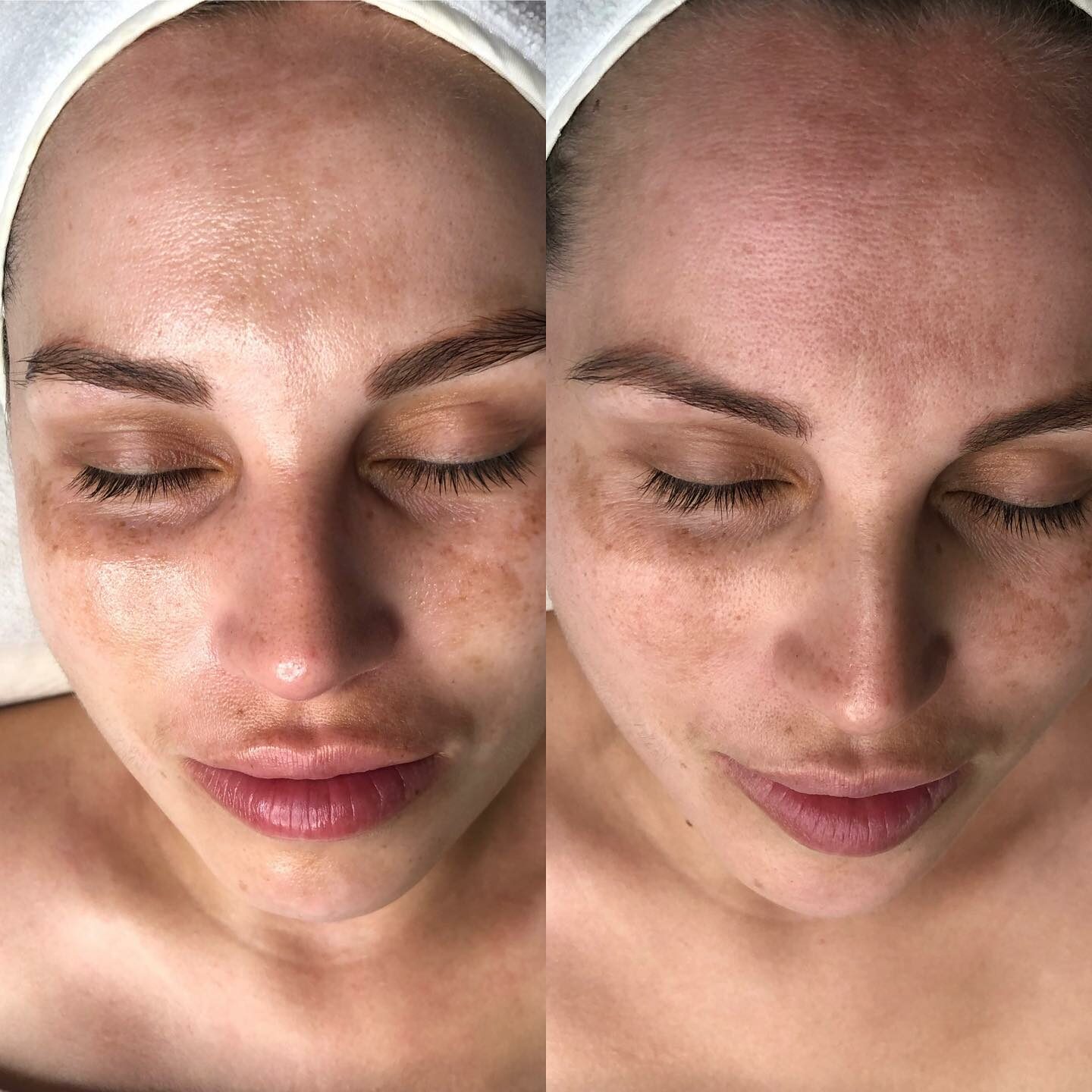 VERTEX Cosmetology Cape Town